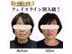 ドロップ(Drop)の写真