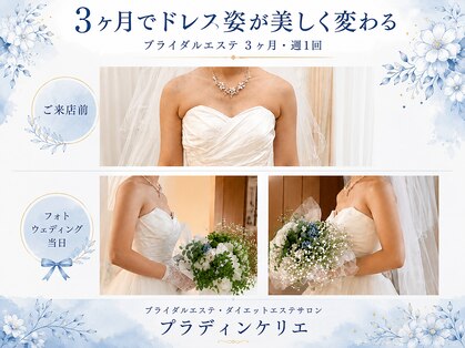 プラディンケリエの写真