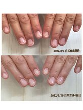 ウェリナ(welina)/自爪育成　2ヶ月目