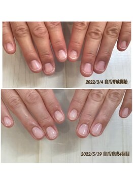 ウェリナ(welina)/自爪育成　2ヶ月目