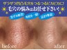 人気No1【毛穴引き締め】ダイヤモンドピールで角質ケア☆期間限定￥4,400