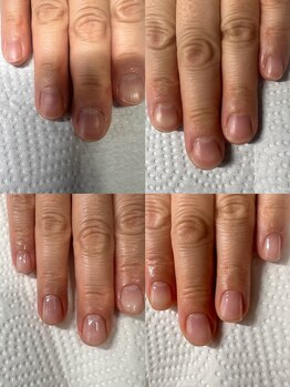 カンパニュラ(Campanula)/自爪育成3ヶ月コース