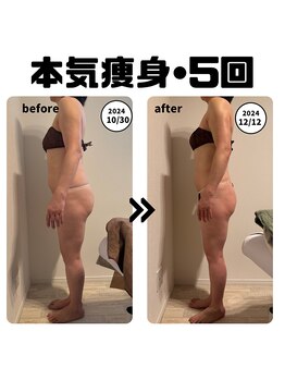 レガリア(LEGAREA)/