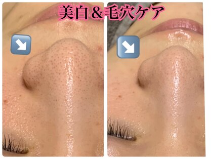 イアリイの写真