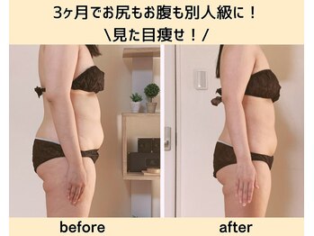 ヨサパーク ルアナ(YOSAPARK Luana)/3ヶ月で別人級に見た目痩せ!