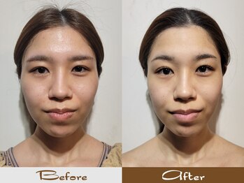 ハカハカ(HAKA HAKA)/美容頭蓋小顔矯正×美白パック