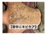 【背中ニキビケア】剥けないハーブピーリングで美背中に♪¥18,150→￥9,980