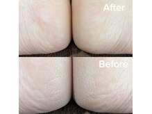 プレヴナンス(Prevenance)