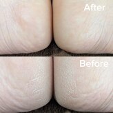 プレヴナンス(Prevenance)