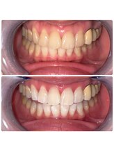 コナホワイトニング 神保町/セルフホワイトニング神保町