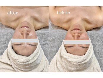 サロン スリーバイエス(salon THREE/S)/大人気◎美肌引き締めコース