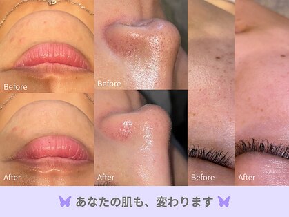 リエラ(Riella)の写真