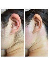 サロンアンドスクール ローズマリー (Salon&School Rosemary)/うなじ　もみあげ　首　Wax¥6600