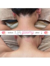 グルーミー(gloomy)/うなじワックス脱毛♪