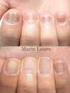 深爪改善/自爪育成/ネイルケア