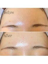 アイラッシュTokyo銀座サンクチュアリ/LED/眉毛/パリジェンヌ/バインド