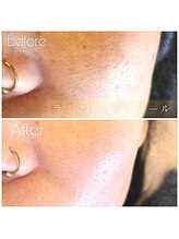 シャンブル(Chambre)/