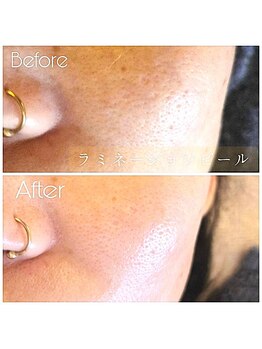 シャンブル(Chambre)/