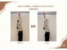 陽だまり整体院/お客様のビフォーアフター♪