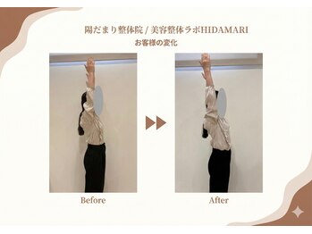 陽だまり整体院/お客様のビフォーアフター♪