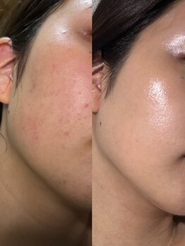 アルテ 神戸(Arte)/