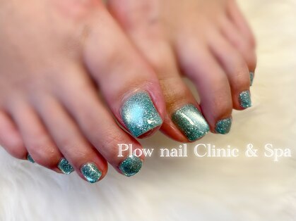 プラウネイル(Plow Nail)の写真