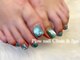 プラウネイル(Plow Nail)の写真