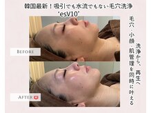 エクラ アン(eclat.un)の雰囲気（毛穴ケアの韓国最新技術！毛穴洗浄の常識が変わるかもしれません）