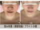 アルページュ(Arpege)の写真/韓国人気★エステ版チタニウムリフト【小顔輪郭×高ハリ×色白シミケア×毛穴レス】一度で叶う欲張り美容
