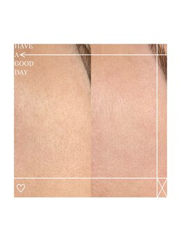 アクトウーマン(AKTWOMEN)/フェイシャルワックス　ツヤ肌