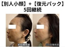 ティエル 高崎店(Tiele)/【お顔全体の変化】