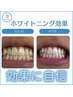 【1日完結型ホワイトニング】ワンデー超美白ホワイトニング20分×3回10000円