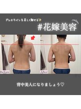 エルベ(ellbe)/ellbe式パワーレメディ筋膜痩身