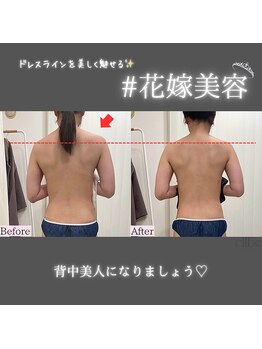 エルベ(ellbe)/ellbe式パワーレメディ筋膜痩身