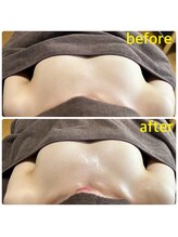 エヌ(N)/【バストアップ】