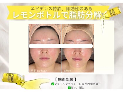 エステティックサロン フェアリー(ESTHETIC SALON FAIRLY)の写真