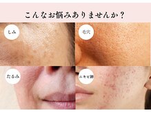 エルナ(ELUNA)/セルマン