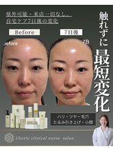 シェリー(Cherie)/話題インセルダム!小顔たるみ7日