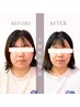 【フェイスラインすっきり・むくみ改善】小顔整体 初回体験