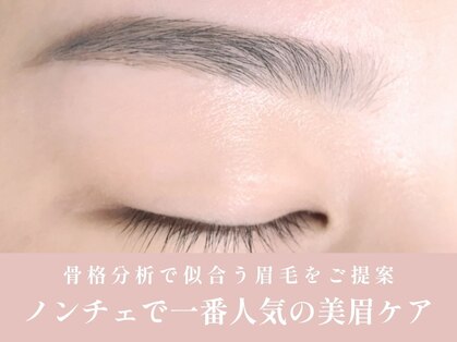 ノンチェ(Nonche)の写真