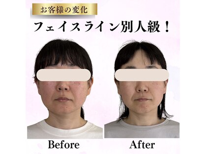 ドロップ(Drop)の写真