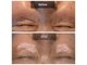 フェイス フェイス(FACE×FACE)の写真