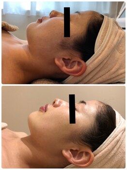 エイシスグロウ(asis glow.)/効果写真