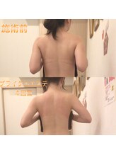 ディア スプリーマ/ブライダルエステ4回目