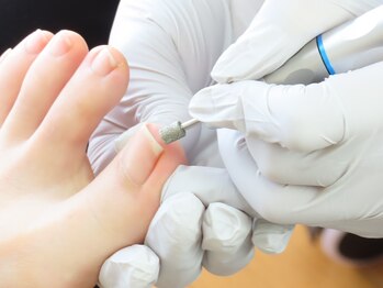 ドクターネイル爪革命 麻布十番店/【長さ調整】