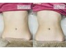 【引き締め】気になる部分を選ぶ+筋膜リリース+生体電流付き