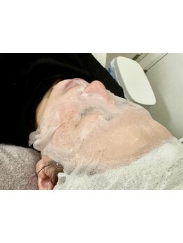 美白ケアをしたい