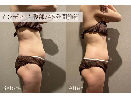 レア(Le'a)の写真