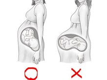 一条整体院/安産整体で、下腹が出ない