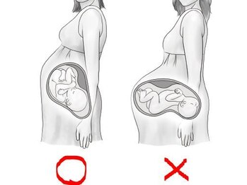 一条整体院/安産整体で、下腹が出ない